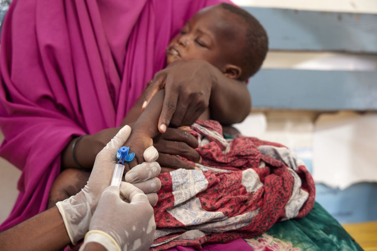 A malnourished baby is treated at a hopsital in Somalia. A person wearing a pink top holds the baby as a doctor inserts a needle into the top of its hand.